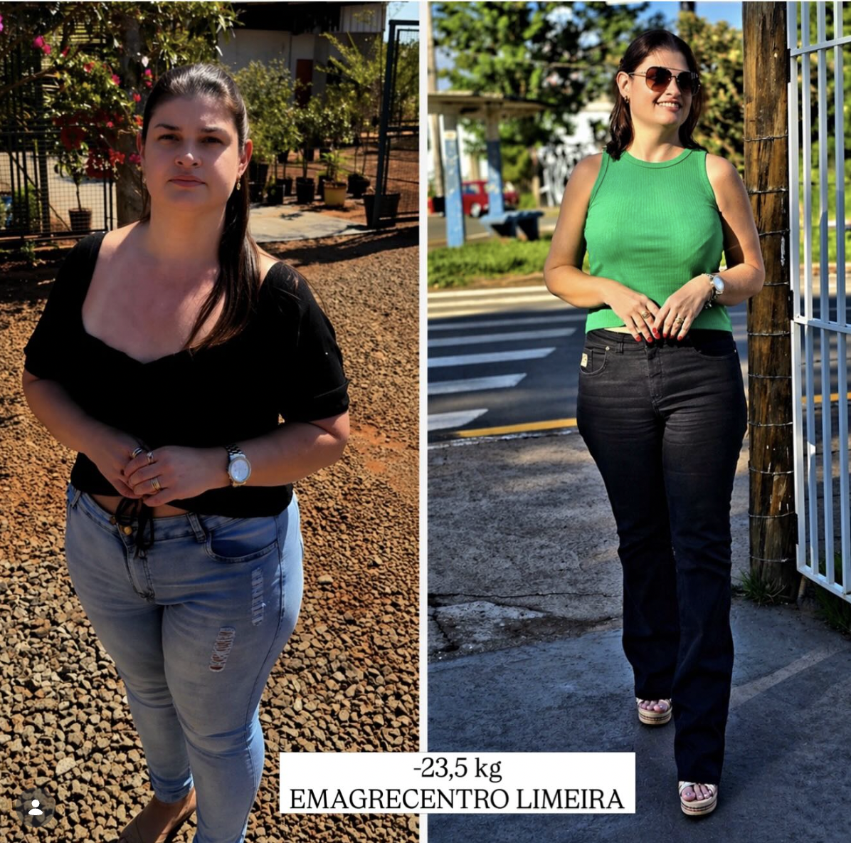 Aline — antes e depois, 23,5 kg eliminados