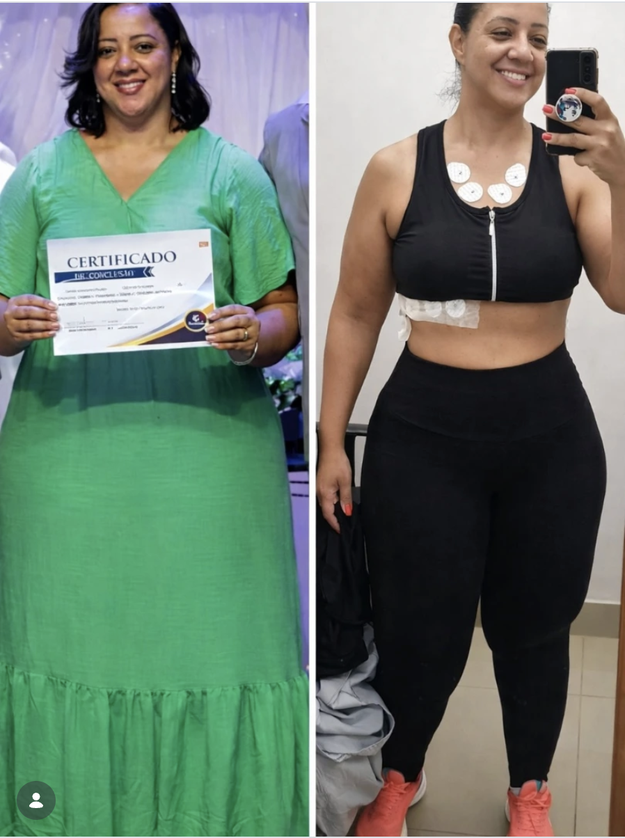 Vania — antes e depois da transformação